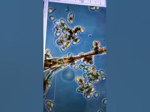 Плесень под микроскопом - YouTube