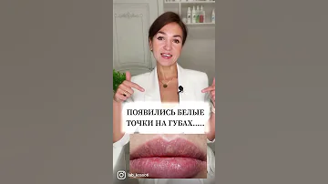 ПОЯВИЛИСЬ БЕЛЫЕ ТОЧКИ НА ГУБАХ
