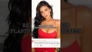 Celebrities Revealing Plastic Surgery Secrets | Board Certified Plastic Surgeon Dr Islur in Winnipeg