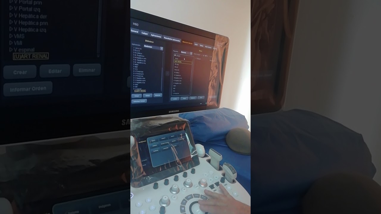 H60 de Samsung. Personalizar medidas.