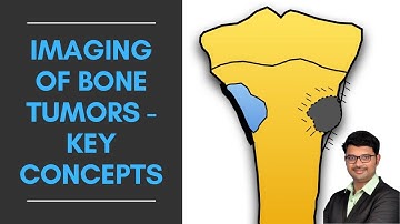 Imaging of Bone Tumors : Key Concepts | Dr. Venkatesh Manchikanti @ShadesofRadiology