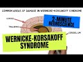 2minute neuroscience wernickekorsakoff syndrome