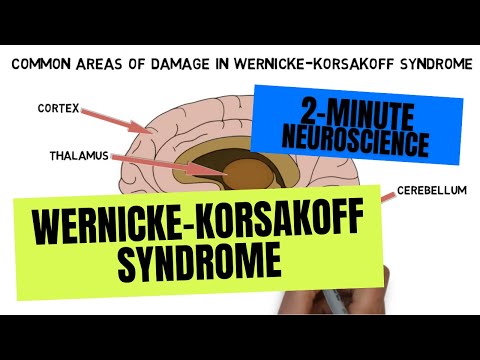 Video: Wernicke-Korsakoff-syndrom: Risiko, årsaker, Symptomer Og Mer