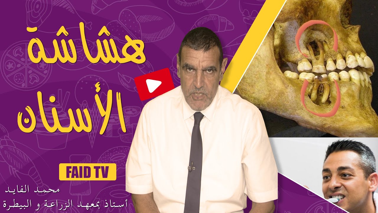 السبب وراء هشاشة الأسنان | الدكتور فائد