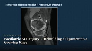 Paediatric ACL Injury — Rebuilding a Ligament in a Growing Knee