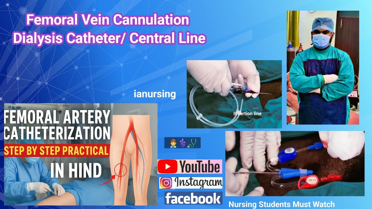 👨‍⚕️ Femoral Vein Cannulation Dialysis Catheter🩸 Central Line(CVP) # ...