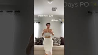 10 Days Post-Op BBL Results | Heal Road