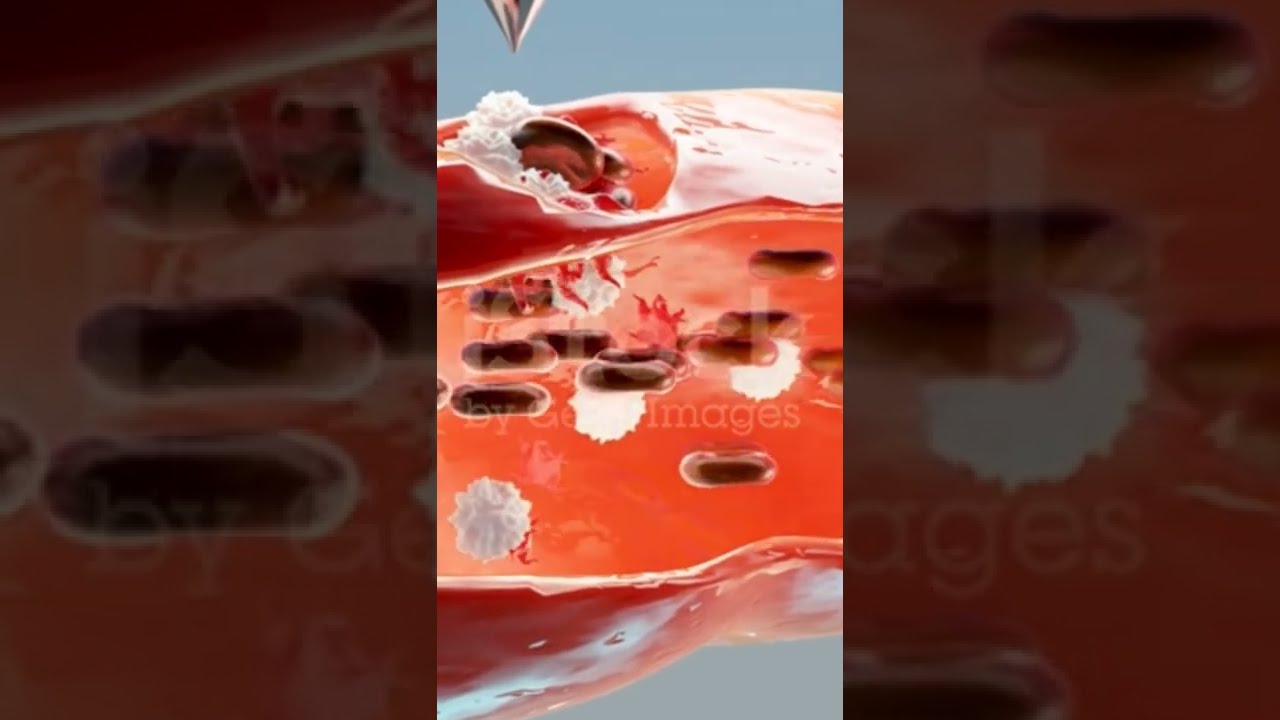 Hemostasis Red Blood Cells And Platelets In The Vessel Basic Steps Of Wound Healing Process 