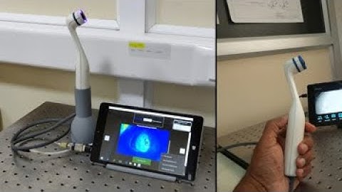 Oral Cancer Screening Tool (E)