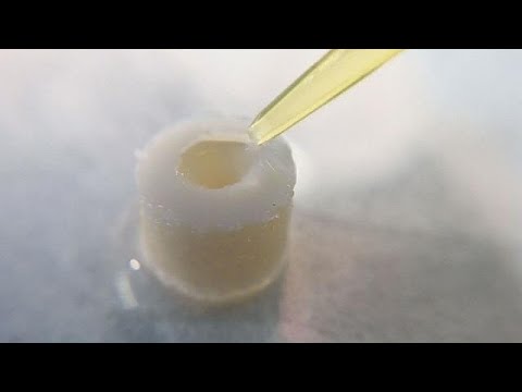 Vídeo: Estudio Sobre La Eficacia Y La Seguridad Del Tratamiento Con Yeso Tong-luo Qu-tong Para La Osteoartritis De Rodilla: Protocolo De Estudio Para Un Ensayo Clínico Aleatorizado, Doble