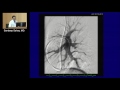 Case Presentation and Discussion (Sandeep Sahay, MD)