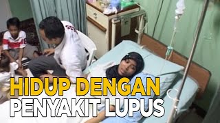 Berjuang hidup normal dengan penyakit lupus | JELANG SIANG