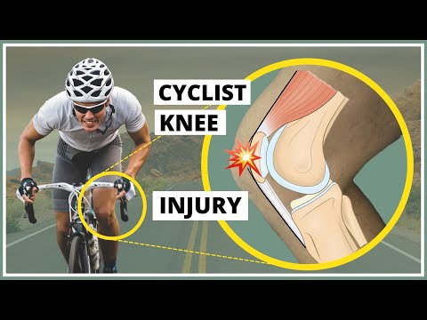 Pre-patellar fascia injury also known as &rsquo;Cyclist&rsquo;s knee&rsquo; (explanation, diagnosis and treatment)