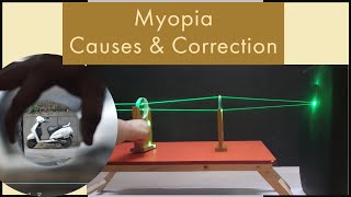 Myopia  Causes and Correction | By Vinod Avnesh