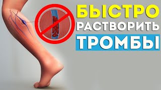 ЭТИ продукты БЫСТРО растворяют ТРОМБЫ в сосудах  Тромбоэмболия, варикоз, профилактика тромбоза