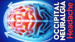 ⚡OCCIPITAL NEUROLOGIA: The rare & infamous headache