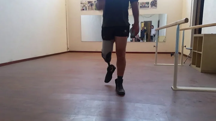 ProtheFlex soft socket combined with RoadWalking foot from Roadrunnerfoot