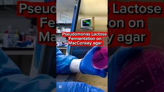 Blood culture for identify lactose fermentative bacteria on MacConkey agar