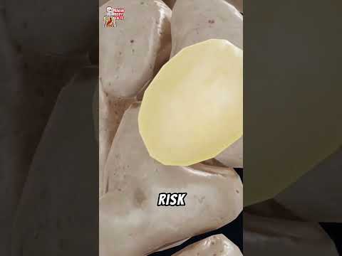 The pisiform bone!