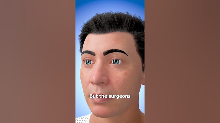 How Eye Transplants Work 👁️