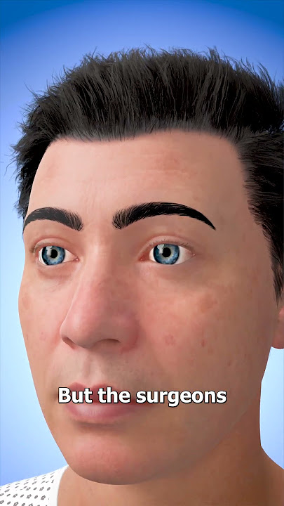 How Eye Transplants Work 👁️