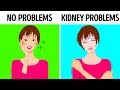 10 Signs Your Kidneys Aren’t Working Properly