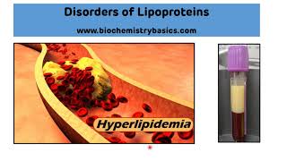 Lipoprotein Disorders || Hyperlipidemia Biochemistry || Dyslipoproteinemias
