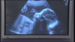 Ohio bill would prevent insurance for paying for abortions, limit birth control coverage
