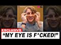 “MY EYE IS HALF BLIND!” Paddy Pimblett Breaks Silence on SERIOUS Eye Injury After UFC 324!