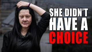 Ex-Boyfriend s Acid Attack Left Her Unrecognizable Then She Did This