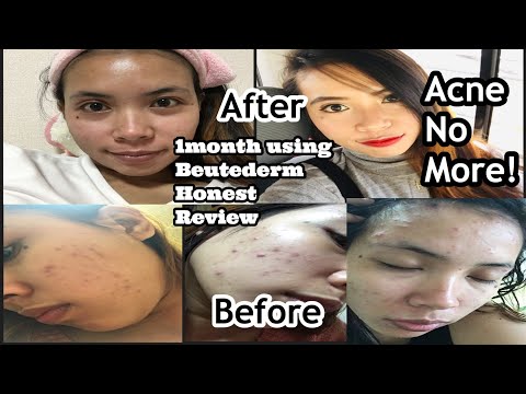solusyon-sa-acne-and-scars/skincare-beautederm-honest-review/factory-worker-in-japan/lifestyle