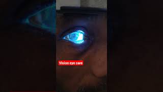 corneal ulcer eyecare eyediseases eyeproblems cataract