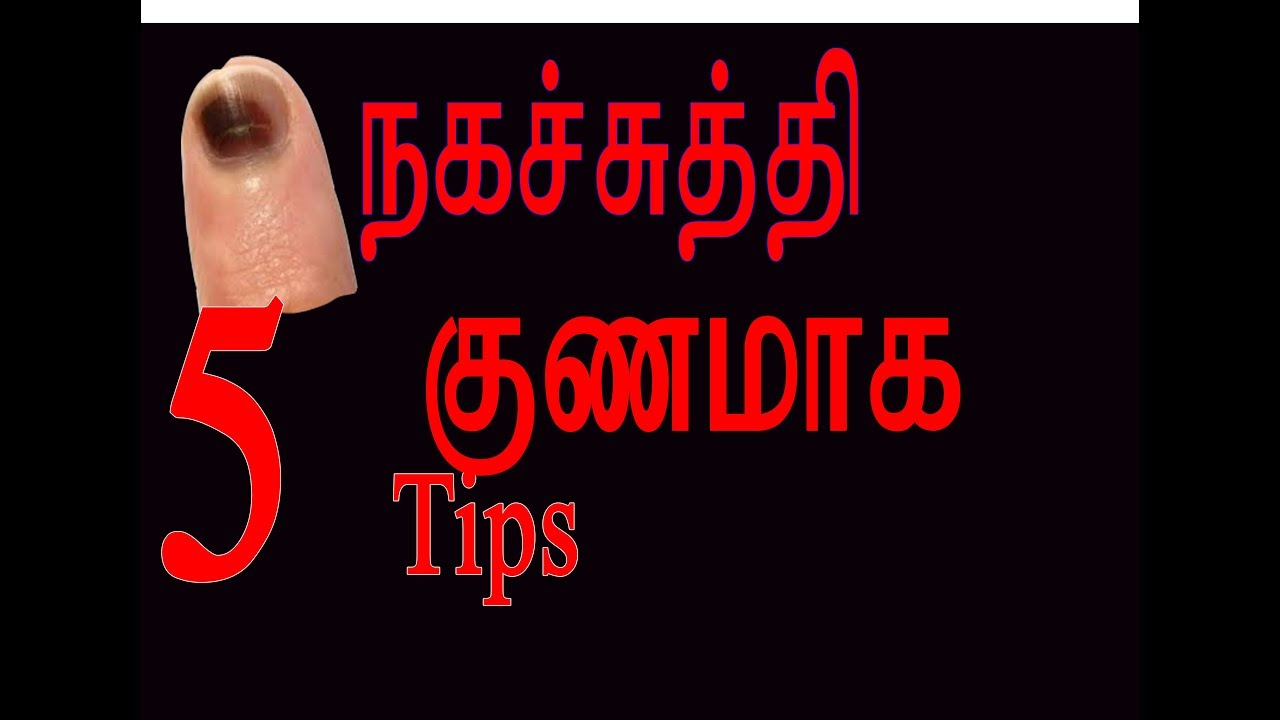 Top 5 Treatement for nail infection in tamil,Negasuthi Tamil, Cure
