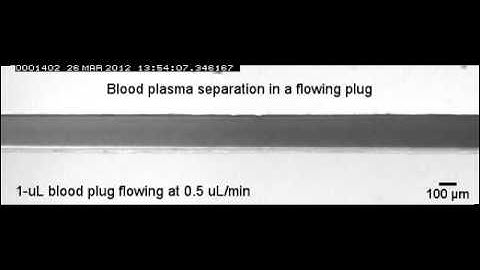 Blood plasma separation in a long two-phase plug flowing through disposable tubing
