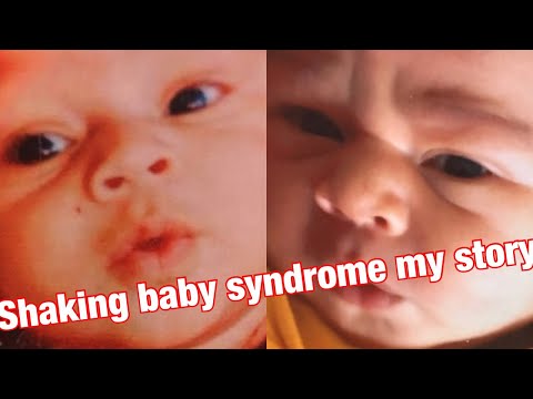 Video: Shaken Baby Syndrome: Symtom, Orsaker Och Behandlingar