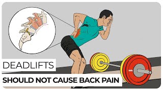 The Cause of Loẁer Back Pain After Deadlifts