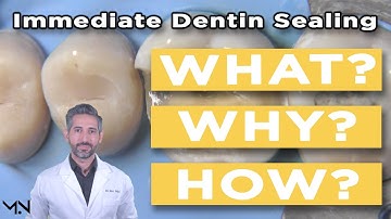 Immediate Dentin Sealing | Biomimetic Dentistry | What, Why, and How to Perform