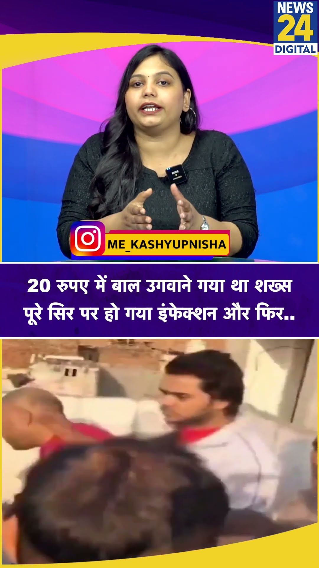 Meerut Oil Scam: 20 रुपए में बाल उगवाने गया था शख्स पूरे सिर पर हो गया इंफेक्शन और फिर..