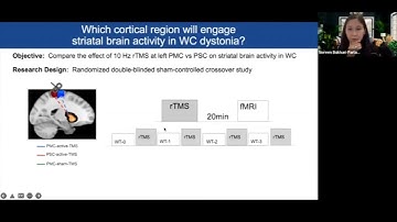 Non Invaise Neuromodulation to Study Long Term Plasticity Mechanisms in Task Specific Dystonia -- DC