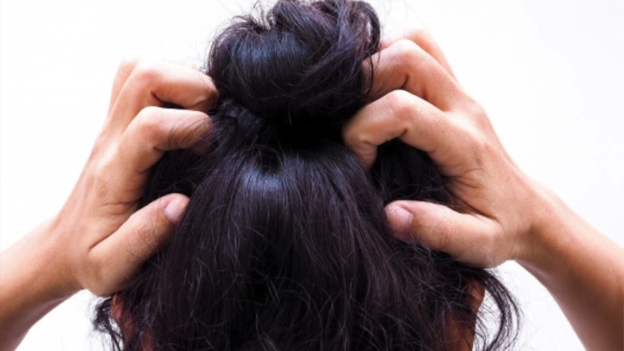 Trichodynia - painful hairs