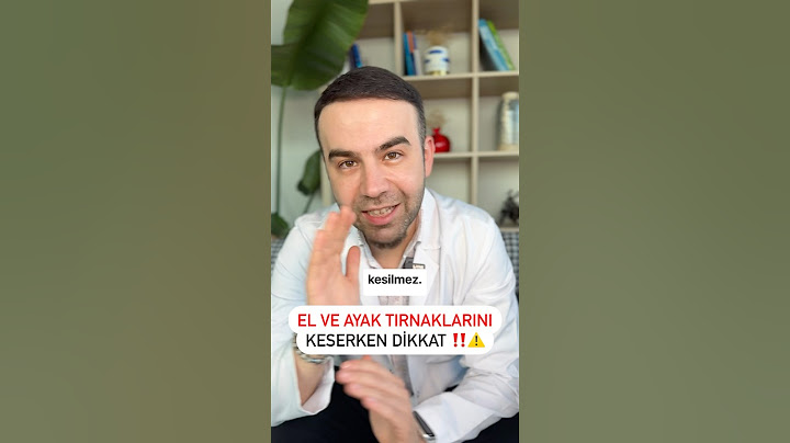 El tırnaklarıyla ayak tırnaklarını aynı şekilde kesiyorsan, büyük bir hata yapıyorsun😅