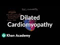 Dilated cardiomyopathy: Pathophysiology and diagnosis | NCLEX-RN | Khan Academy