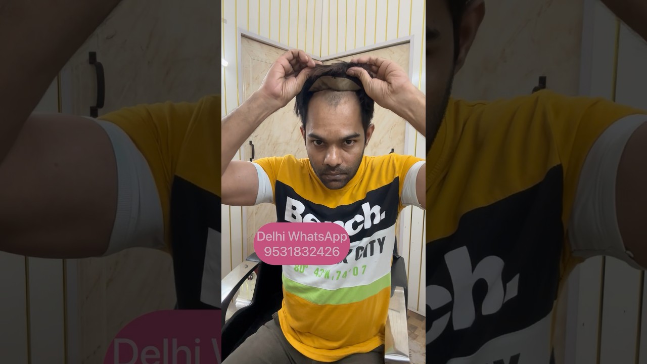 Monofilament hair patch 