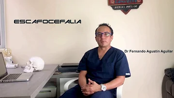 Como prevenir la escafocefalia?