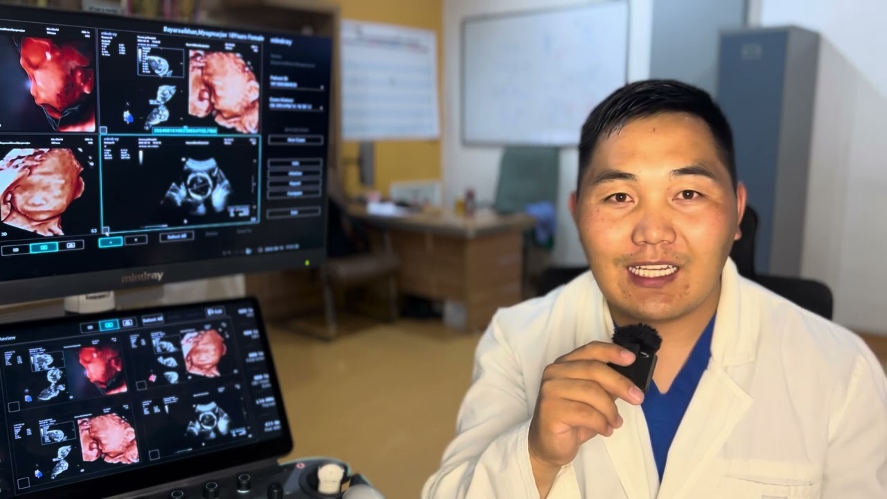 37-38 долоо хоногтой жирэмсэн бол үзээрэй( ураг)