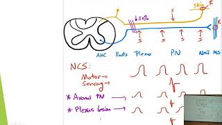 6. Quick Reviews: EMG and Nerve Conduction Study