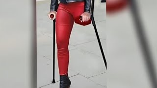 Beautiful Amputated Girl Full Of Vitality And Positive Energy(7)#Amputee#Crutches#Walking#Amazing