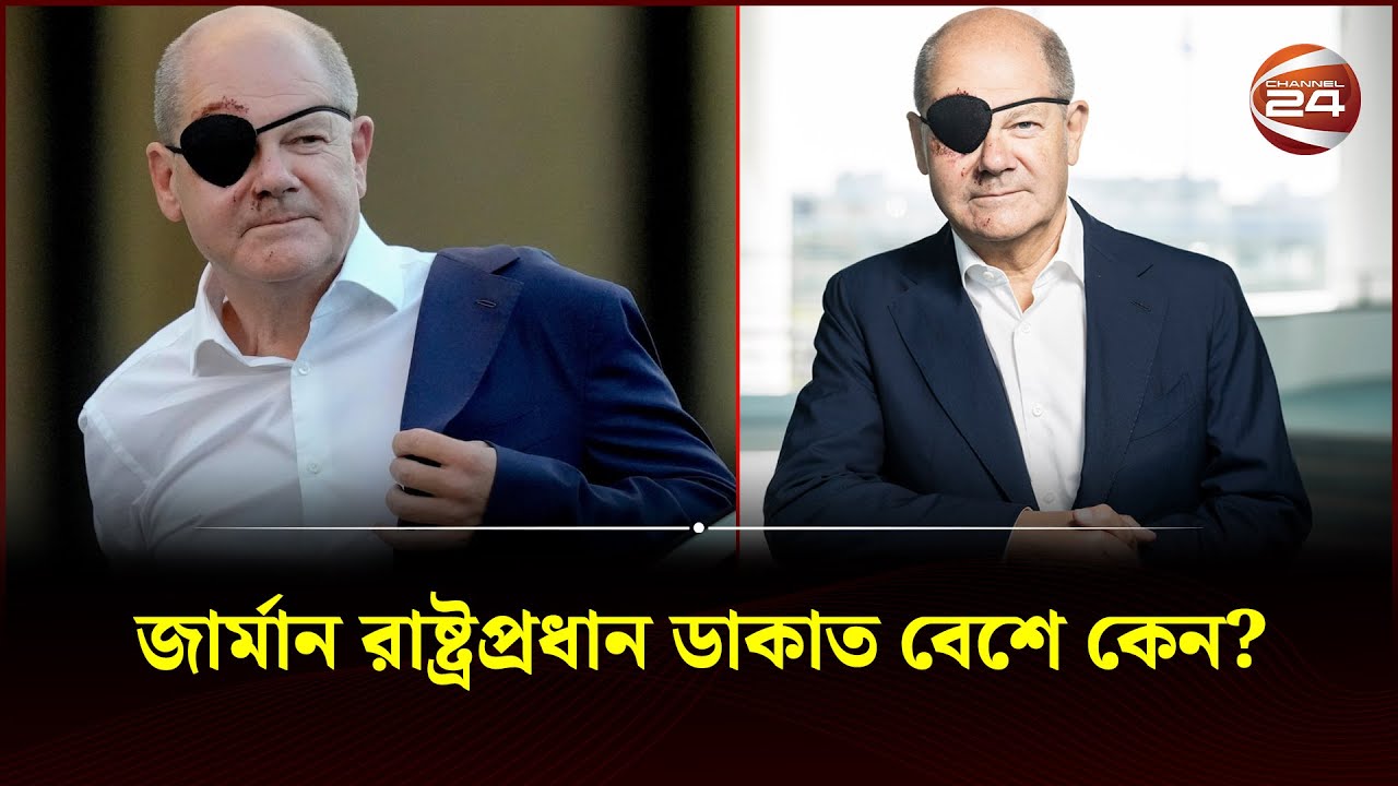 জার্মান রাষ্ট্রপ্রধান ডাকাত বেশে কেন? | German Chancellor Black Eye ...