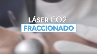 Láser Co2 Fraccionado en Perú 2023 ➪ Clínica Continental