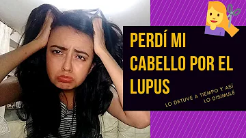 ¿Cómo curar el lupus en el cuero cabelludo?